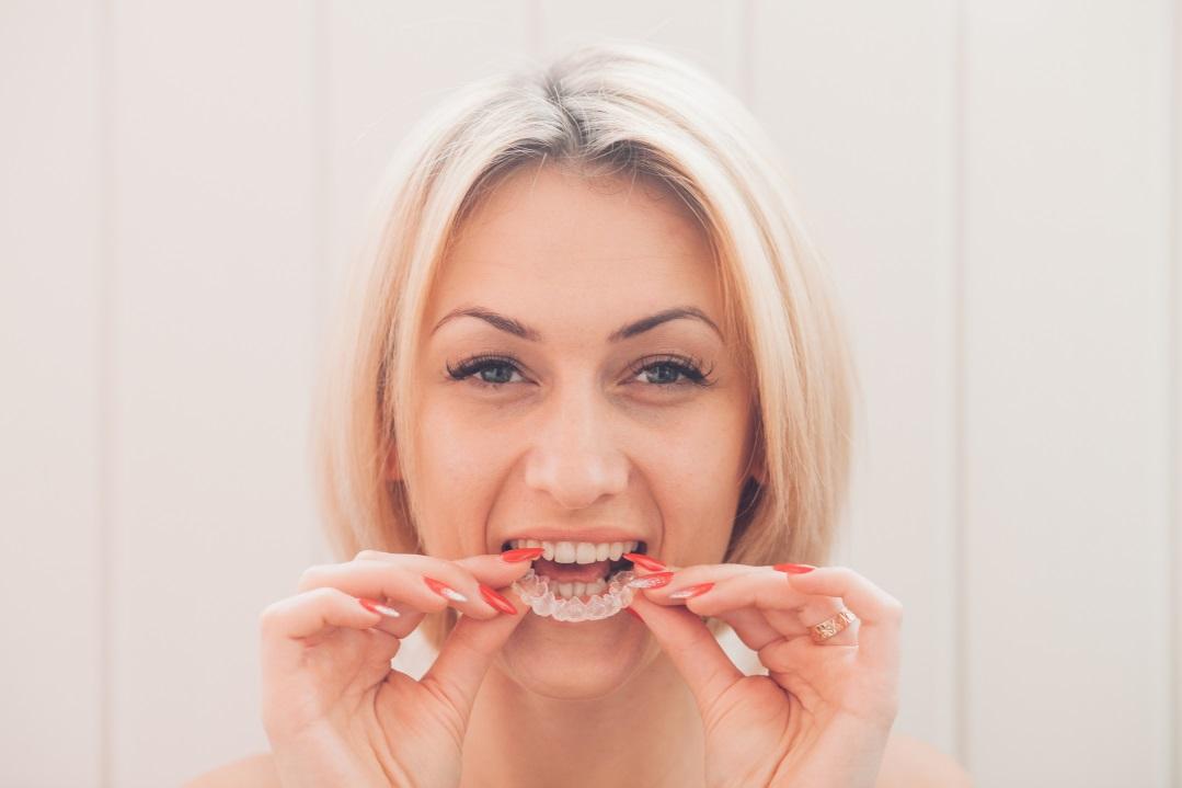 What to Expect When Your Braces Come off Smile Elements 2
