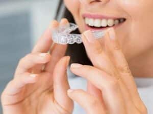 How to clean Invisalign 