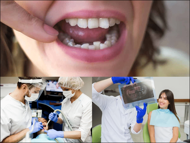 How Orthodontics Can Correct Crowded Teeth